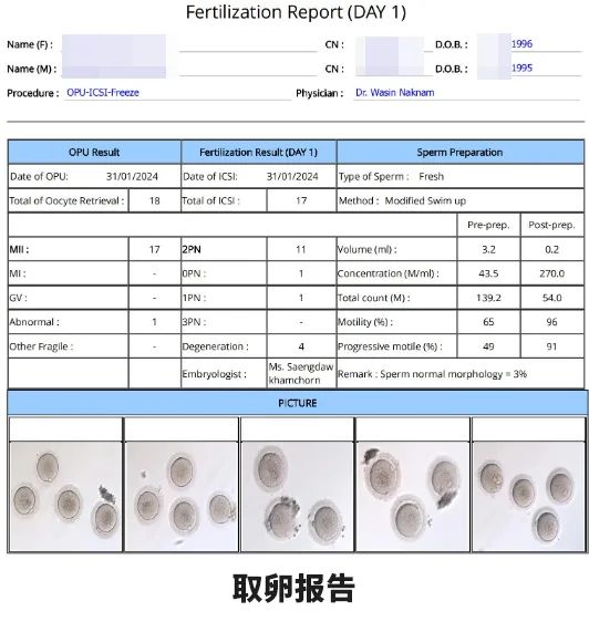 取卵報(bào)告 取卵報(bào)告
